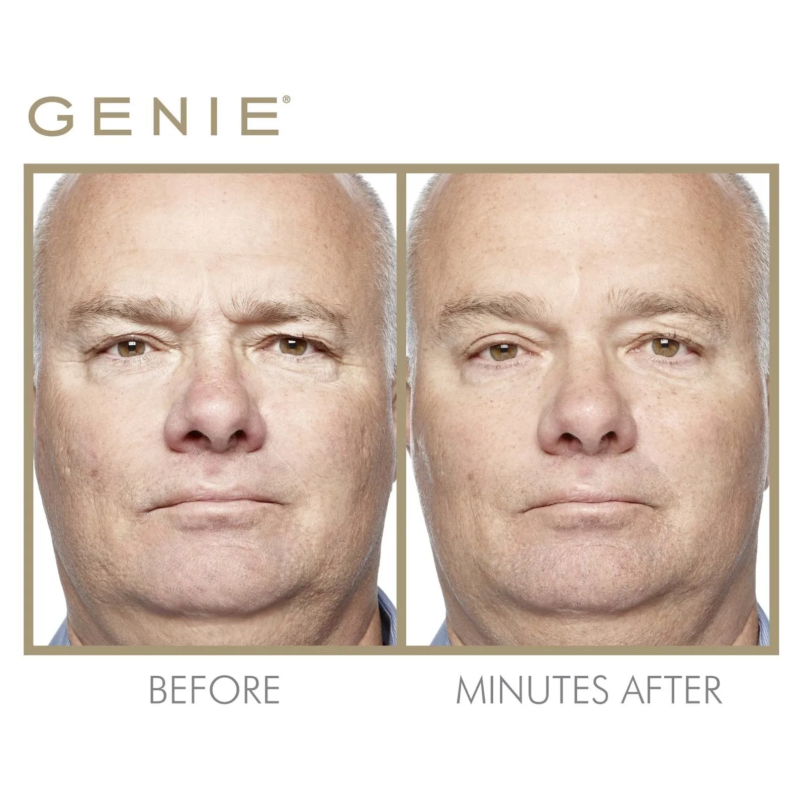 Market Live: Genie Instant Smoother 30 ml by Genie Beauty (Ships in 2-3 Weeks)